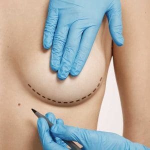 Pls 26 | pacific sound plastic surgery