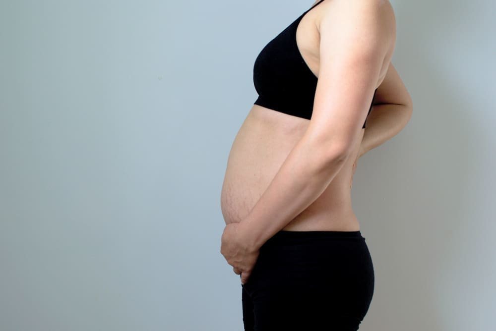 Good candidates for a mommy makeover