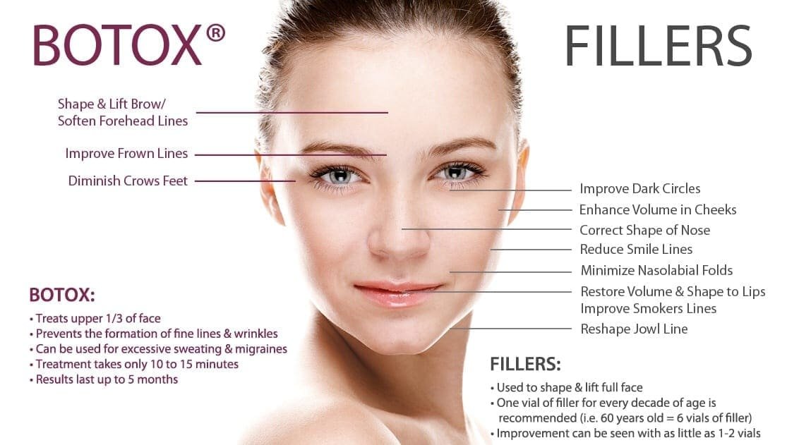 Botox and dermal filler “3-to-5 rule”