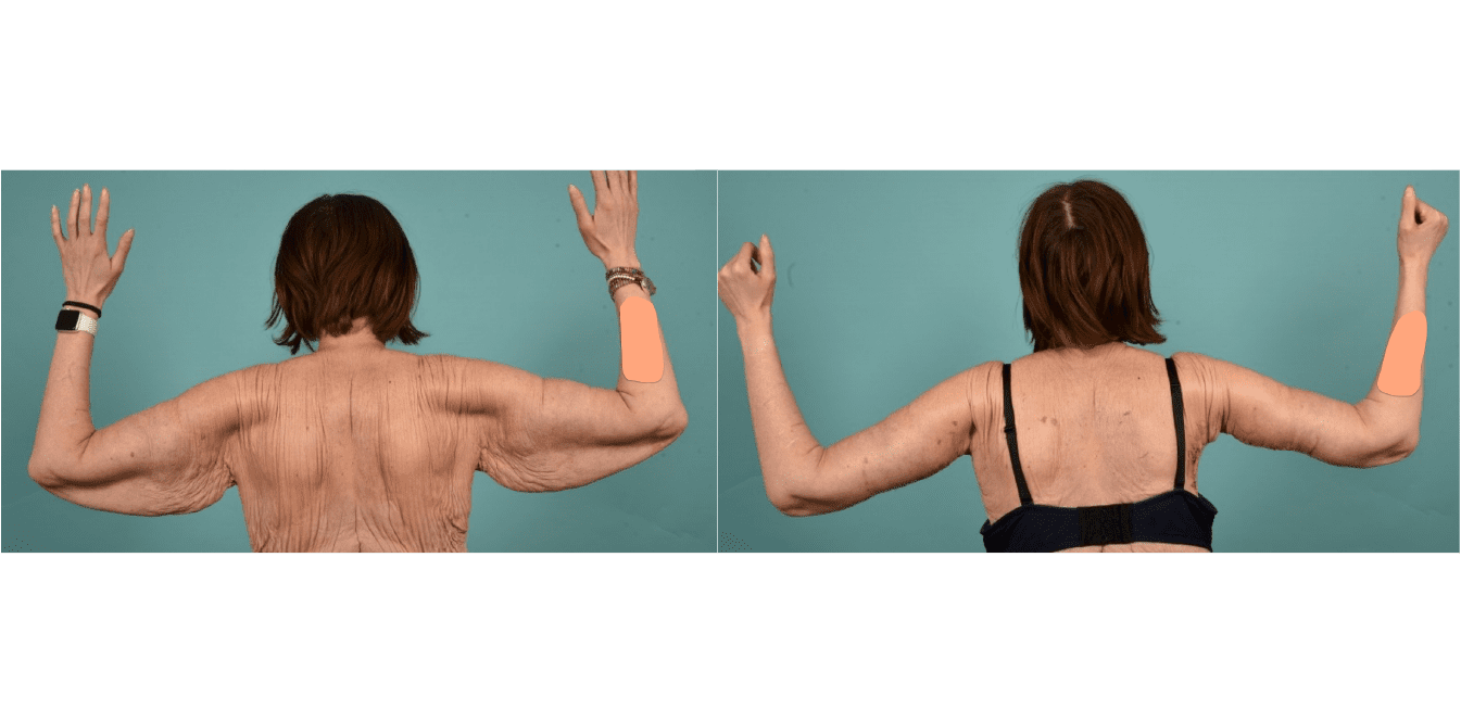 Before and after-03