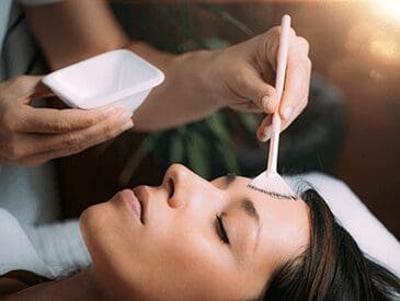 Chemicalpeel 365x275 1 | pacific sound plastic surgery