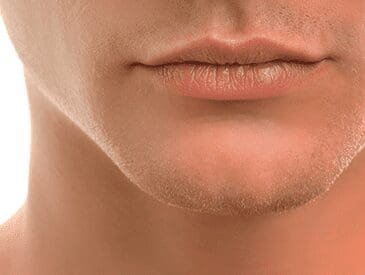 Chinaugmentation | pacific sound plastic surgery