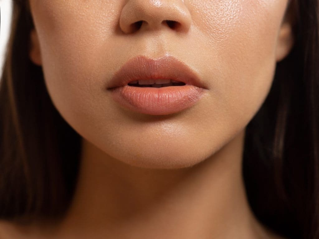 Lipflip recovering | pacific sound plastic surgery