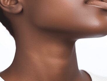 Trachealshave | pacific sound plastic surgery