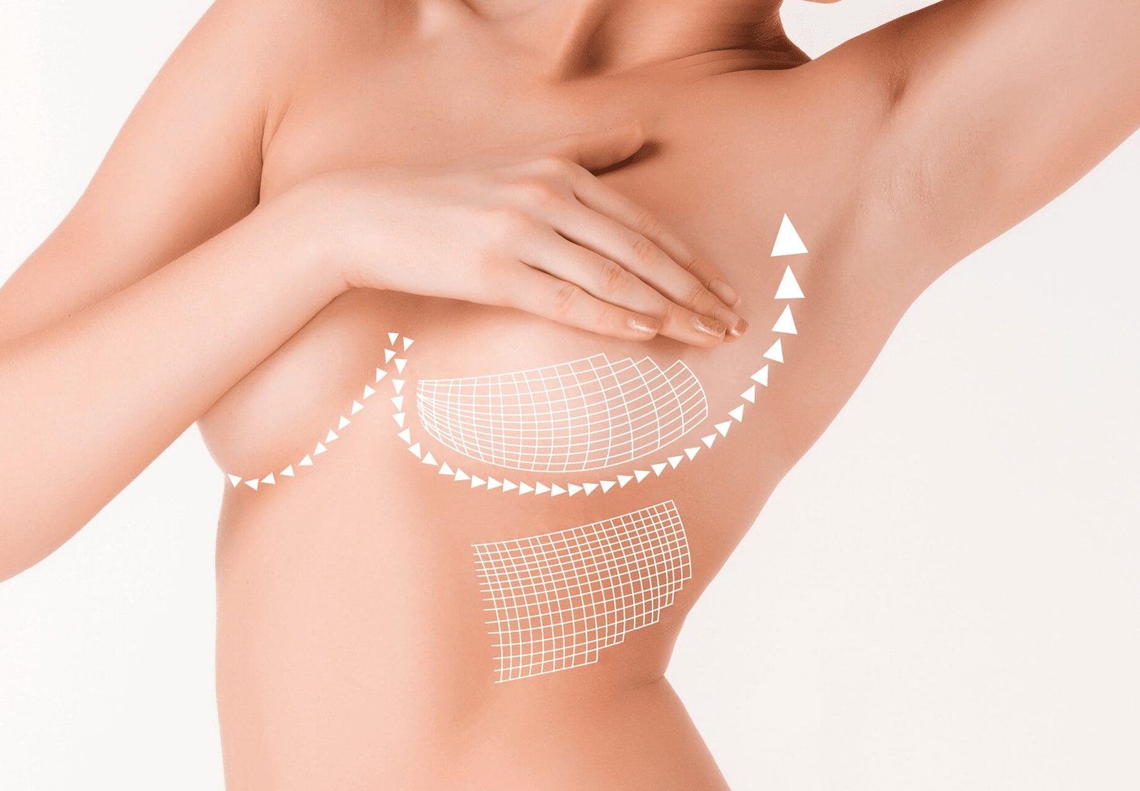 Galaflex “Internal Bra” Breast Suspension 1 Galaflex “internal bra” breast suspension