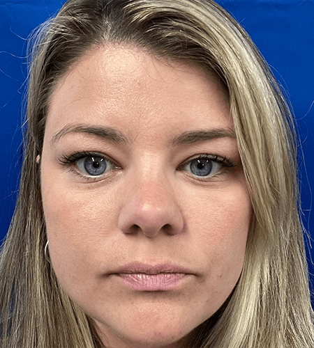 | pacific sound plastic surgery
