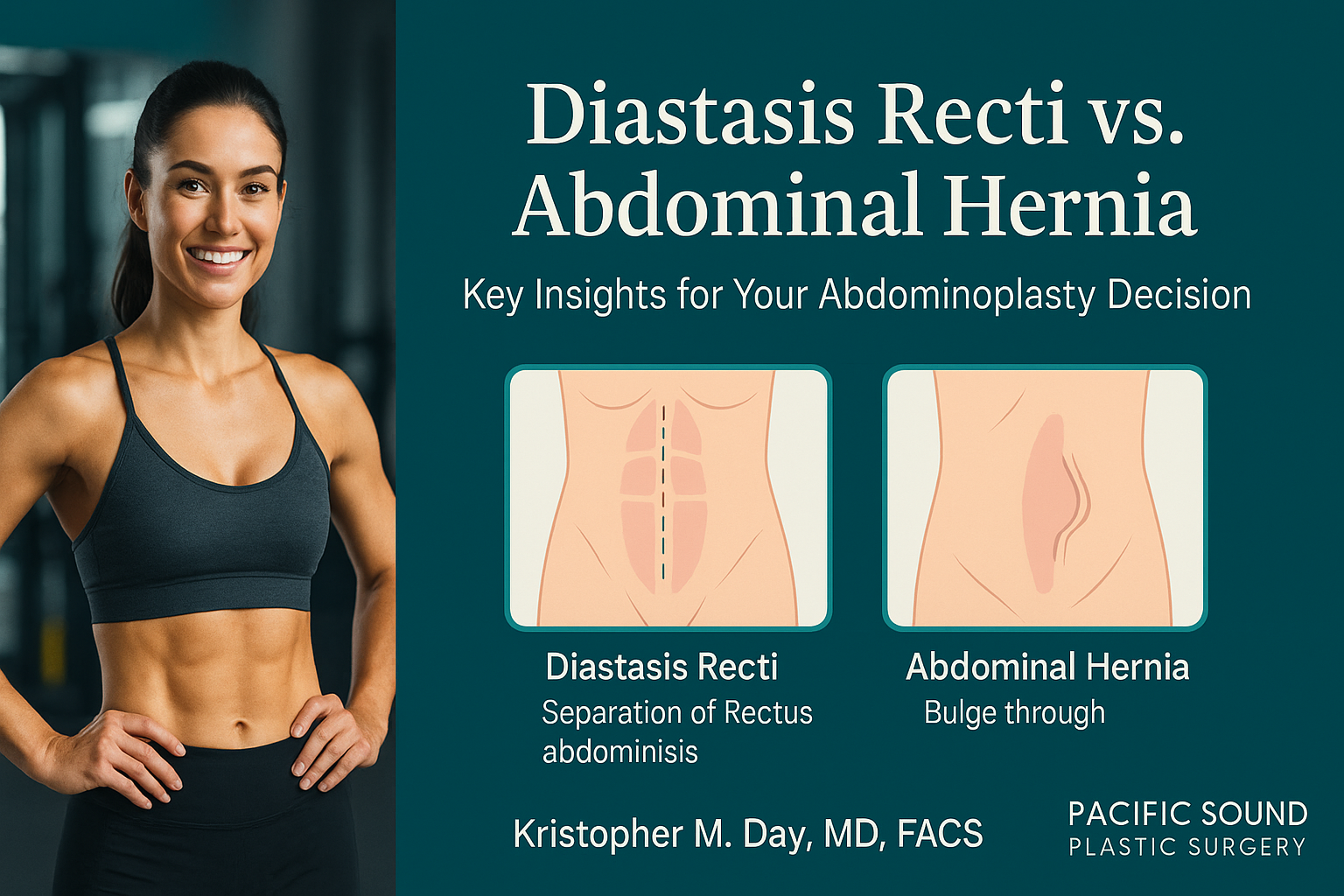 Understanding diastasis recti vs. Abdominal hernia: key insights for your abdominoplasty decision