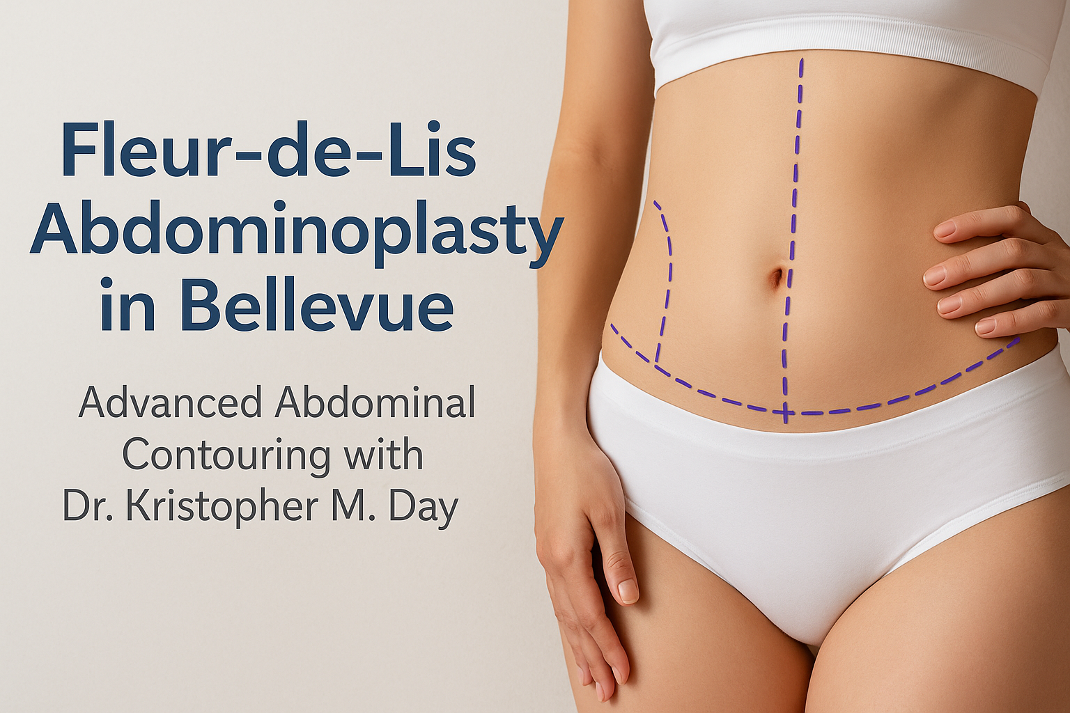 Fleur-de-lis abdominoplasty in bellevue: advanced abdominal contouring with dr. Kristopher m. Day